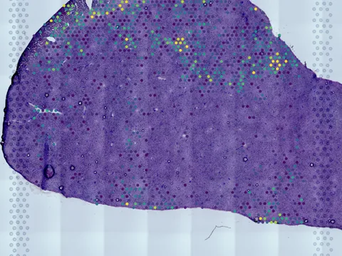 Mouse liver preview