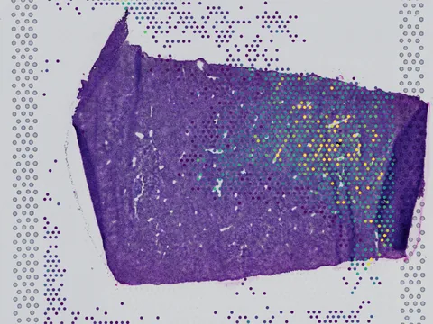 Mouse liver preview