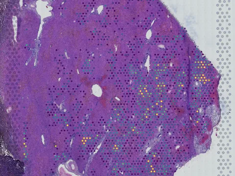 Human liver preview