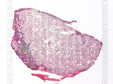 Human liver preview