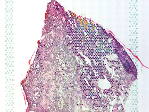 Human lung preview