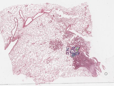 Human lung preview