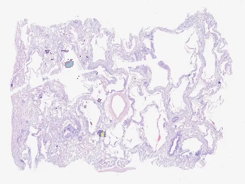 Human lung preview