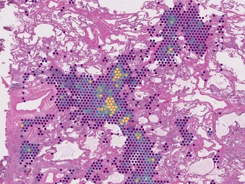 Human lung preview