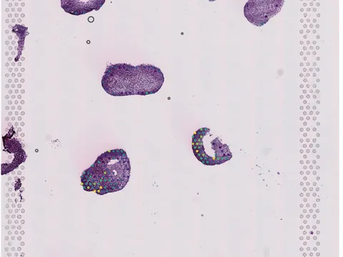Human lung preview