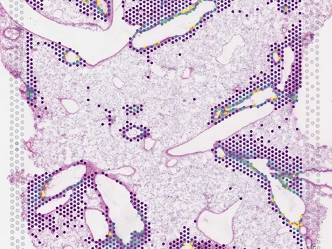 Rat lung preview