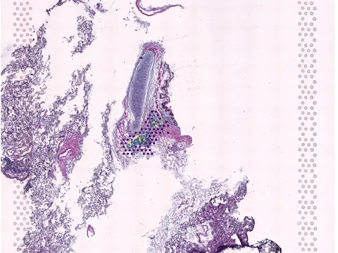 Human lung preview