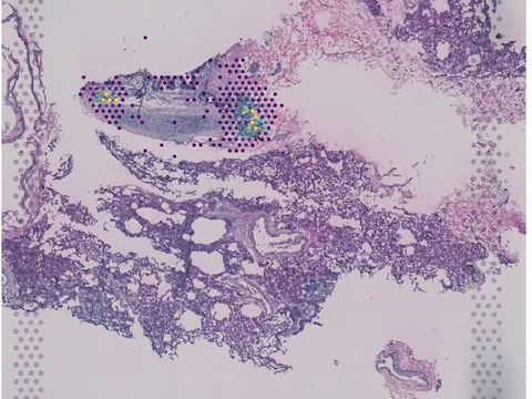 Human lung preview