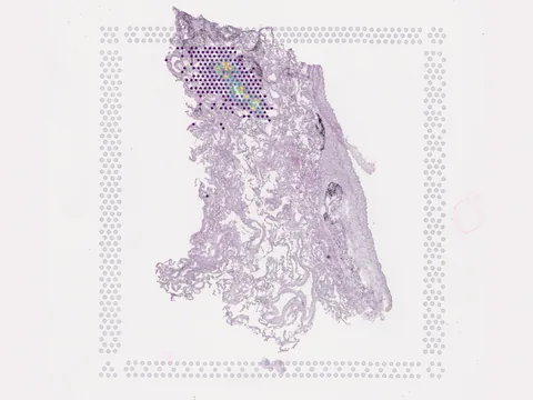Human lung preview