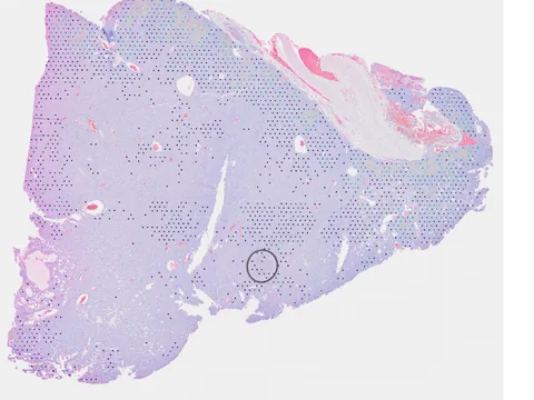 Human lung preview