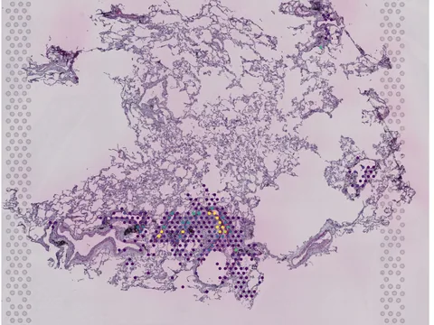 Human lung preview