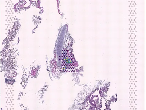 Human lung preview