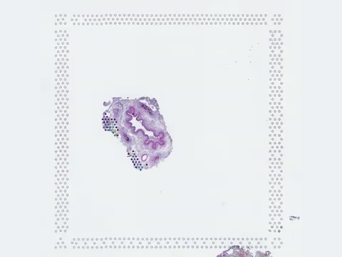Human lung preview