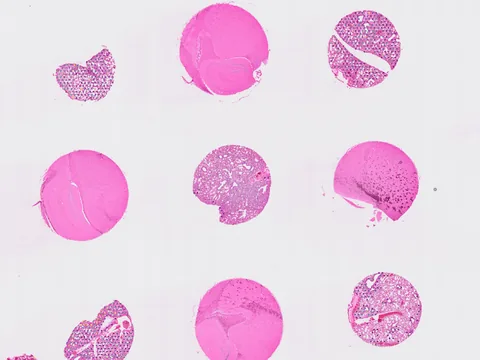 Mouse lung preview