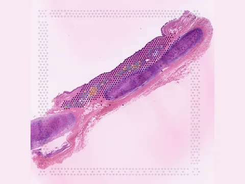 Human lung preview