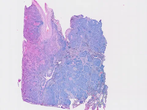 Human lung preview