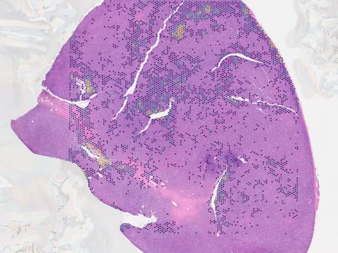Human lymph node preview