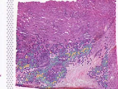 Human lymph node preview