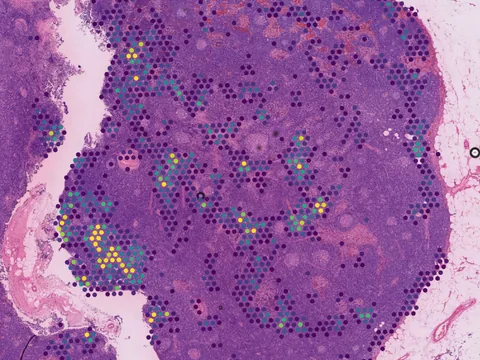 Human lymph node preview