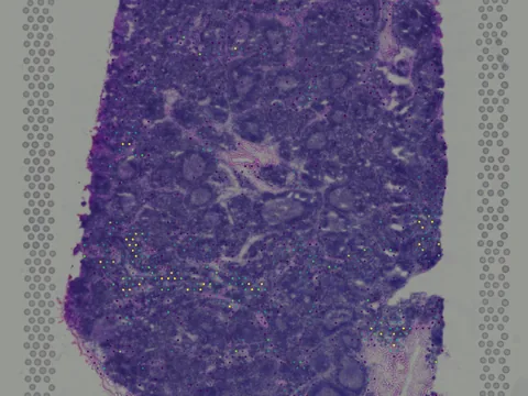 Human lymph node preview