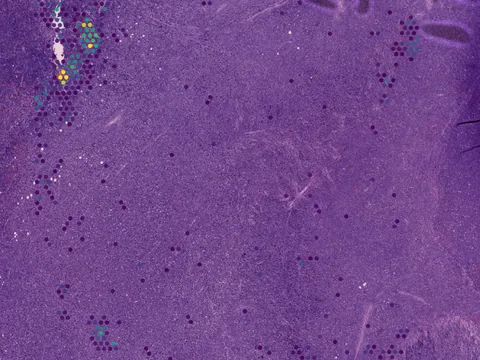 Human lymph node preview