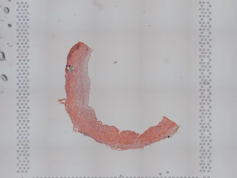 Human mesenteric artery preview