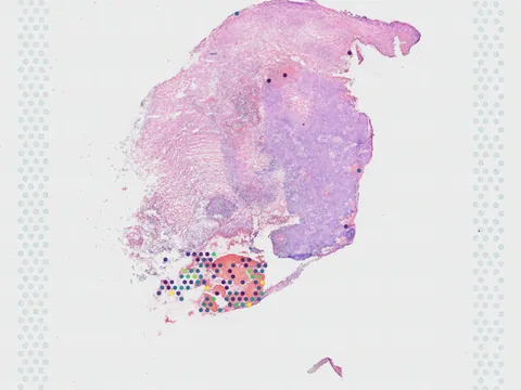 Human nasopharynx preview