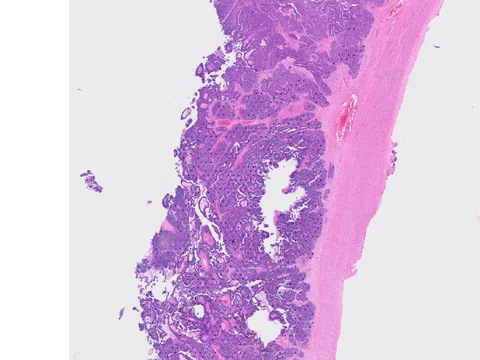 Human ovary preview