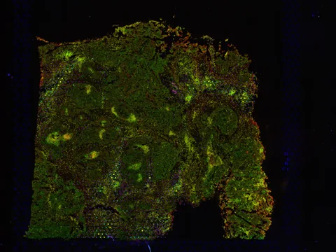 Human ovary preview