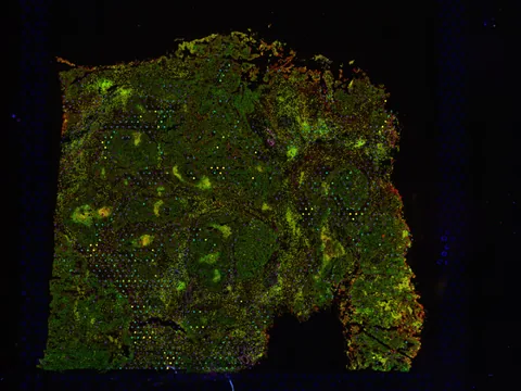 Human ovary preview