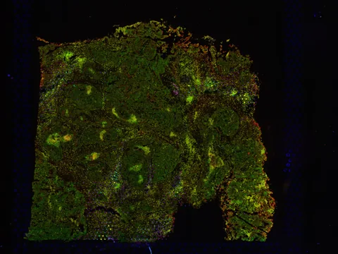 Human ovary preview