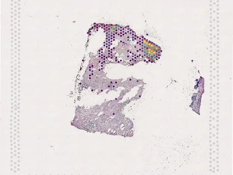 Human ovary preview