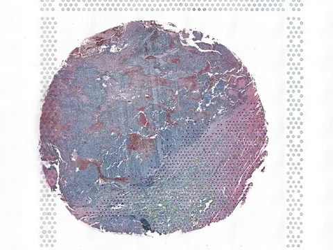 Human ovary preview
