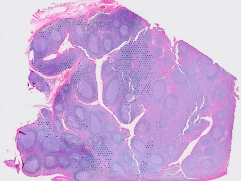 Human palatine tonsil preview
