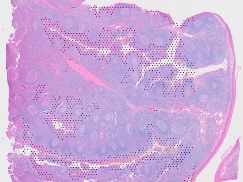 Human palatine tonsil preview
