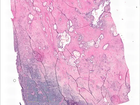 Human pancreas preview