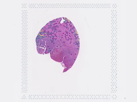 Human pancreas preview