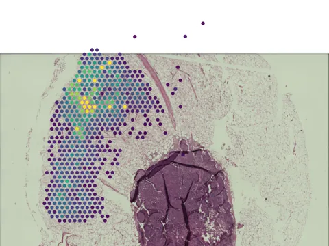 Human pancreatic lymph node preview