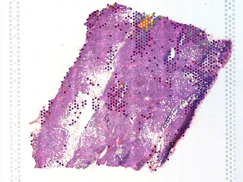 Human peritoneum preview