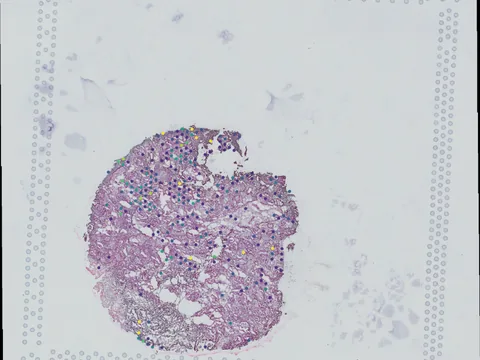 Human placenta preview