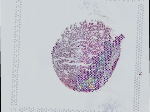 Human placenta preview