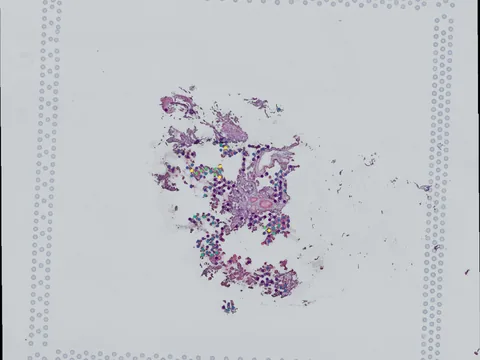 Human placenta preview