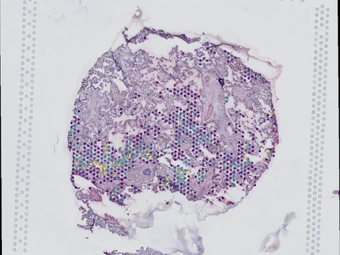 Human placenta preview