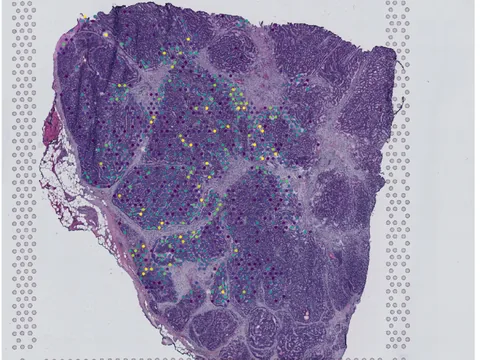 Human prostate gland preview