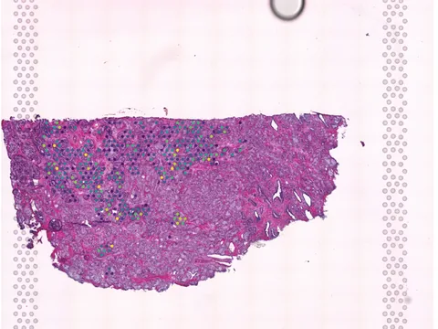 Human prostate gland preview