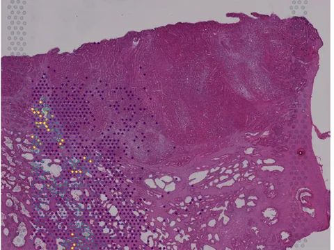 Human prostate gland preview