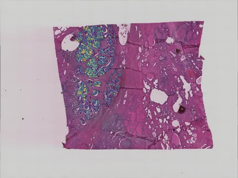 Human prostate gland preview