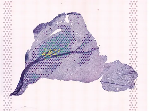 Human prostate gland preview