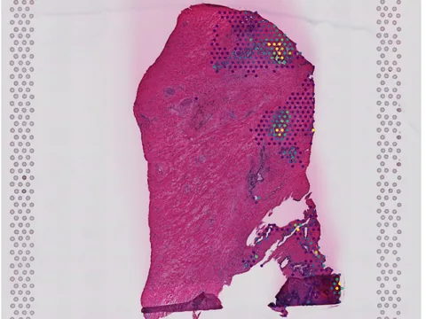 Human prostate gland preview
