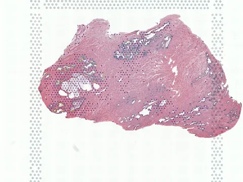 Human prostate gland preview